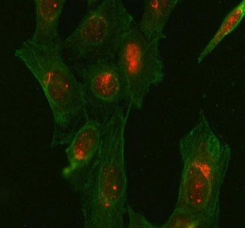Immunofluorescent staining of FFPE human U-2 OS cells with Glycogen synthase kinase-3 beta antibody