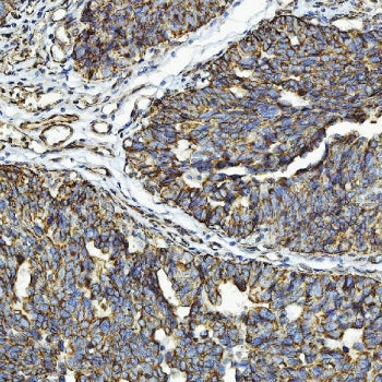 CXCR7 Antibody