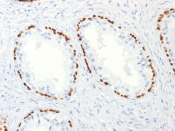 p63 Antibody / Tumor protein 63