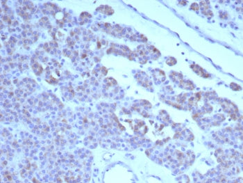 IHC staining of FFPE human parathyroid tissue with c-RET antibody (clone RET/8791). HIER: boil tissu