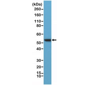 Vimentin Antibody (C-Terminal)