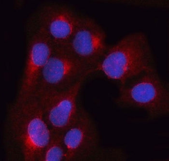 Immunofluorescent staining of FFPE human U-2 OS cells with OSTF1 antibody (red) and DAPI nuclear sta