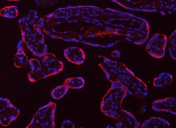 TPM2 Antibody / Tropomyosin 2 / Tropomyosin beta