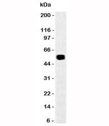 Western blot of rat colon lysate probed with EpCAM antibody (SPM535). Expected molecular weight: ~35