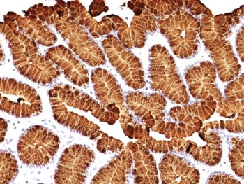 MUC5AC Antibody Cocktail