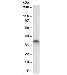 STX11 Antibody