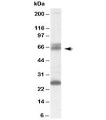 GAD65 Antibody