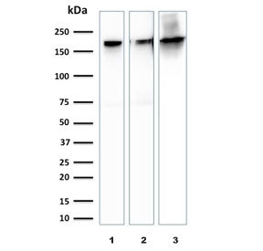 Western blot testing of human 1) HeLa, 2) PC-3 and 3) brain lysate with Spectrin beta III antibody.