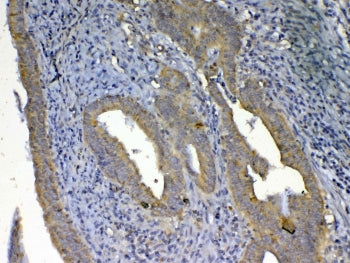 UGT1A1 Antibody