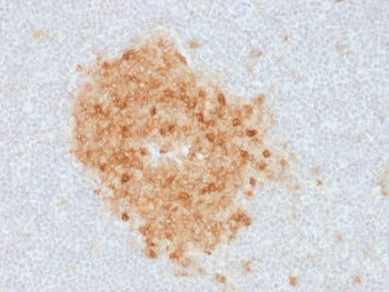 CD10 Antibody / Neprilysin