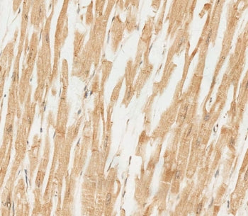 RNF4 Antibody