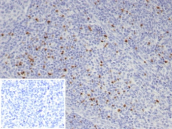 IHC staining of FFPE human tonsil tissue with FOXP3 antibody (clone FOXP3/7990R). Inset: PBS used in