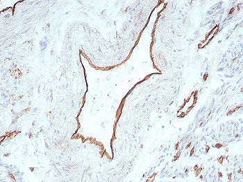 IHC staining of FFPE human uterus tissue with PECAM-1 antibody (clone C31/8831R). HIER: boil tissue
