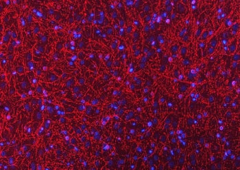 Immunofluorescent staining of FFPE rat brain tissue with CNP antibody (red) and DAPI nuclear stain (