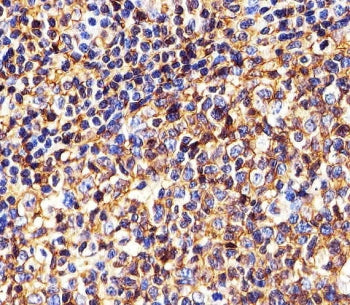 HLA-B Antibody (MHC Class I)