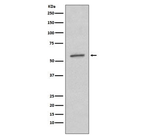 SGK1 Antibody / SGK