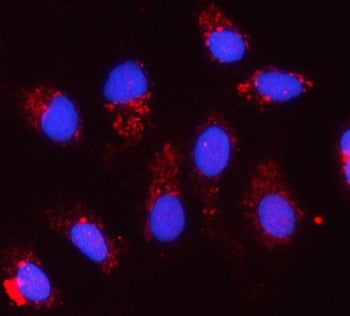 Cytochrome C1 Antibody / CYC1