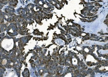 CDC45 Antibody / PORC-PI-1