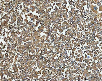 NT5C Antibody / dNT-1