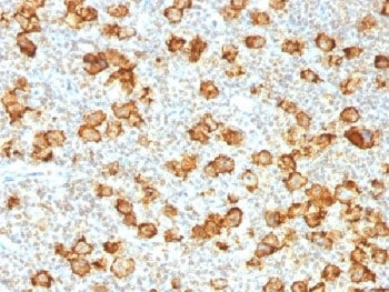 CD30 Antibody