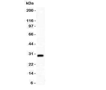SYCP3 Antibody (SCP3)