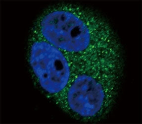 CD14 Antibody