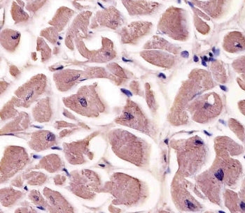 IHC staining of FFPE human heart tissue with Myosin-binding protein C antibody. HIER: steam section