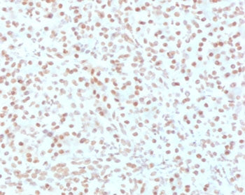 AKT1 Antibody