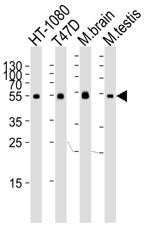 TUBA6 Antibody (Tubulin alpha 6)