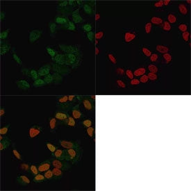 Immunofluorescent staining of methanol-fixed human MCF7 cells with ER antibody (clone ER506, green)