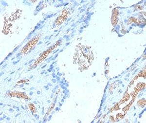 SPTA1 Antibody / Spectrin alpha 1