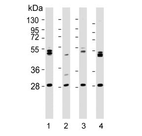 Western blot testing of human 1) 293T, 2) kidney, 3) HL60 and 4) K562 lysate with ARV1 antibody. Predicted molecular weight ~31 kDa.