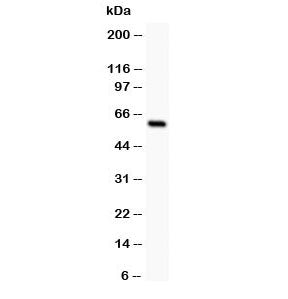 SSTR1 Antibody Somatostatin Receptor 1