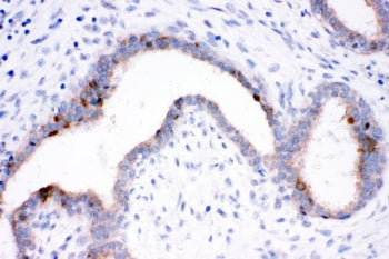 HSP70 Antibody