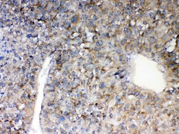 MAVS Antibody (IPS-1)