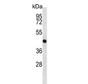 MEK1 Antibody / MAP2K1