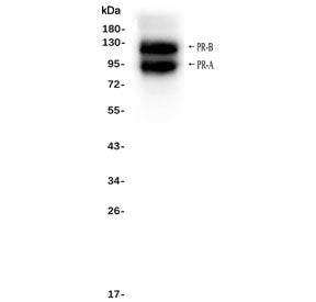 Progesterone Receptor Antibody