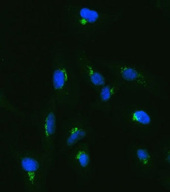 TJAP1 Antibody / PILT