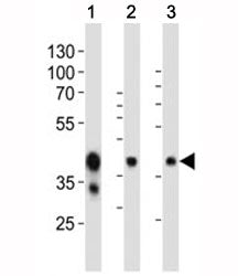 Western blot analysis of mouse tissue lysate using EpCAM antibody at 1:1000. Expected molecular weig