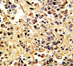 Neprilysin Antibody