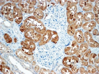 Sclerostin Antibody