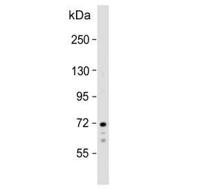 SYK Antibody / Spleen tyrosine kinase