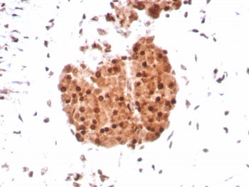 Integrase interactor 1 Antibody / INI-1 / SMARCB1 / BAF47