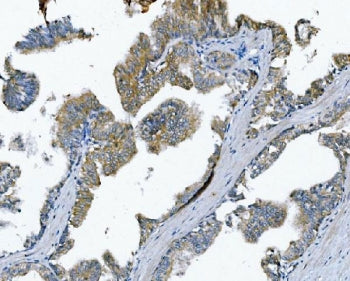 Poliovirus Receptor Antibody / PVR