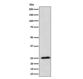 Western blot testing of human HeLa cell lysate with RPL10A antibody. Predicted molecular weight ~25