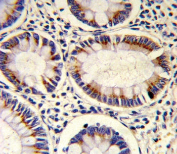 SORBS2 Antibody / ARGBP2