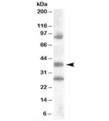 Western blot testing of human kidney lysate with HOXD10 antibody at 0.2ug/ml. Predicted molecular we