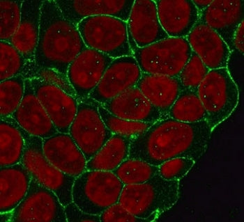 Beta Catenin Antibody