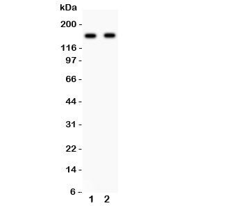 Western blot testing of NR2A antibody and Lane 1: rat brain; 2: mouse brain lysate. Predicted/observ