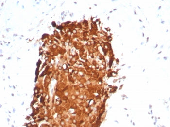 INHA Antibody / Inhibin alpha